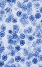 XMRV Virus Particles