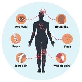 most common symptoms