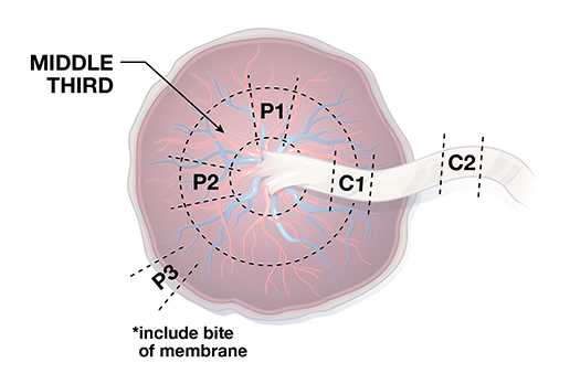 diagram of placenta